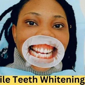 Smile Teeth Whitening Kit