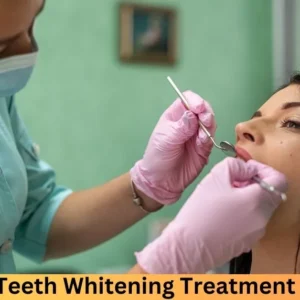 Go Smile Teeth Whitening Treatment Reviews